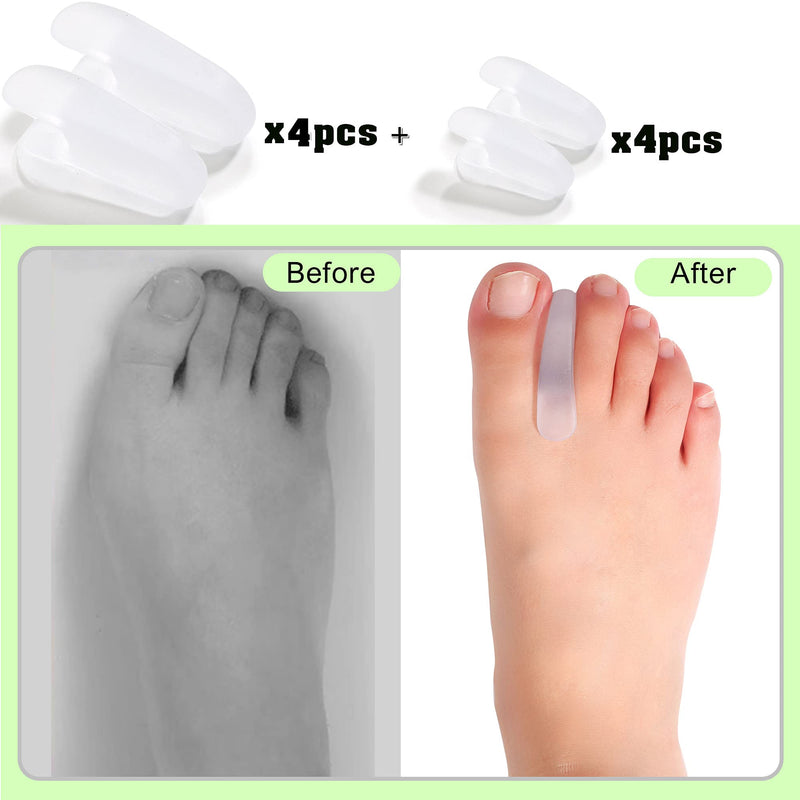DYKOOK Flared Gel Toe Separators 8 Pieces Big Small Toe Spacers Toe Straighteners for Overlapping Toes and Temporary Bunion Corrector Gel (4 pcs Large + 4 pcs Small) - NewNest Australia