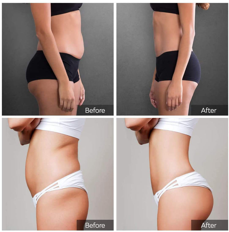Slimming Patches, Pack Of 60 Slimming Patches, Fat Burning Patch On The Belly, Bucket Waist, Belly Fat Waist For Body Tightening Modeling, Anti Cellulite, Quick Weight Loss And Non-Irritating - NewNest Australia