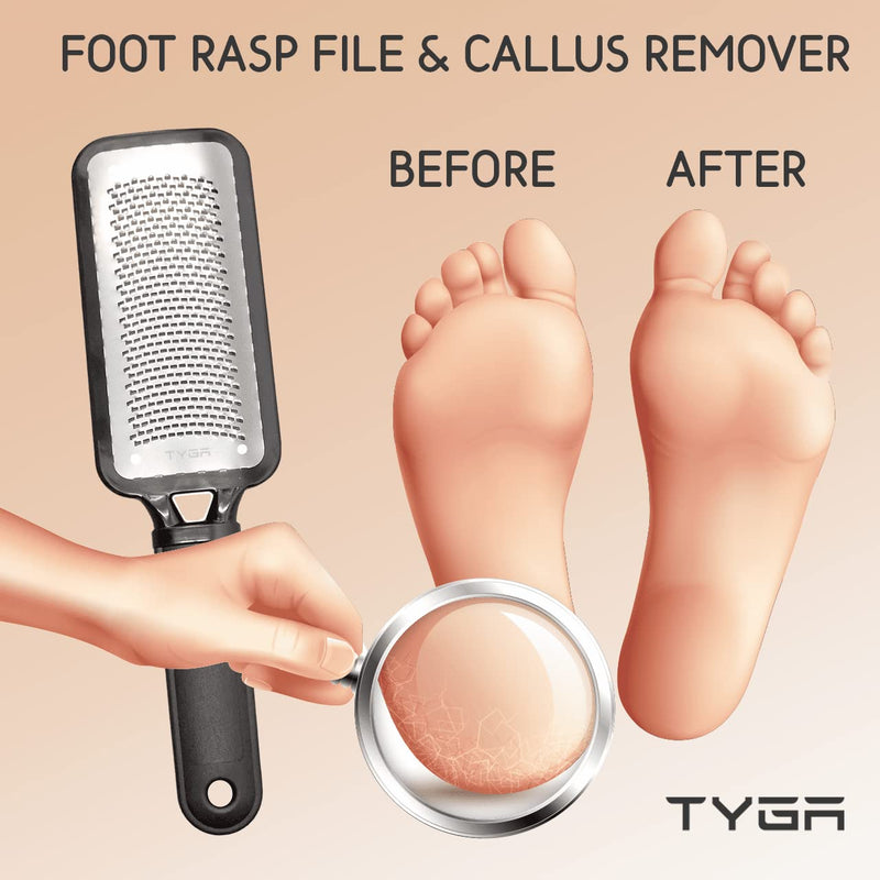 Tyga Foot Rasp Foot File And Callus Remover - Pedicure Tool For Removing Dead Skin, Feet Hard Skin Remover, Foot Scraper, Can Be Used On Both Wet And Dry Feet - NewNest Australia