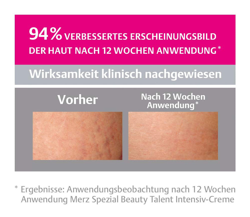 Merz Spezial Stretch Marks Intensive Cream - Special intensive care to reduce stretch marks - improves the appearance of the skin - 1 x 75 ml - NewNest Australia