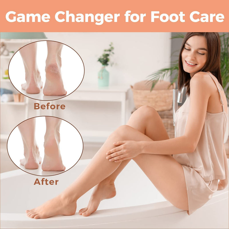 Easkep Foot File Foot Pedicure Tool, Stainless Steel Foot Scrubber Foot File Dead Skin Remover for Hard Skin and Dry Cracked Feet Scraper Classic - NewNest Australia