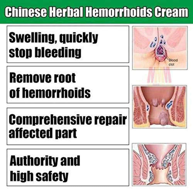 Hemorrhoid Cream, Chinese Herbal Hemorrhoid Cream Piles Treatment Ointment & Fissure Gel, Multi-Symptom Itching, Bleeding, Swelling, Burning Discomfort(10g) - NewNest Australia