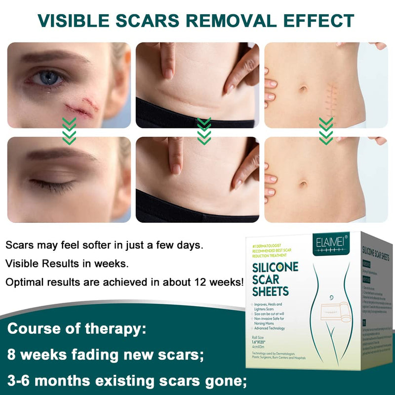 SHEEYOON Silicone Scar Sheets, Silicon Scar Tape Roll，Medical Grade Silicone Scar Removal Sheets, Soften Flatten Fade Scars from Surgery, C-Section, Keloid, Burn, Injury 1.6X120 Inch - NewNest Australia