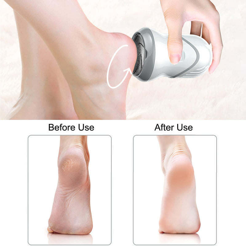 Foot Hard Skin Remover, Electric Foot Files Foot Grinder Pedicure Tools for Removing Calluses, Cracked Dry Dead Skin, with 3 Rollers and 2 Speeds - NewNest Australia