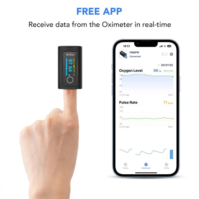Viatom Bluetooth Pulse Oximeter Finger Oximeter With App And 12 Data Sets, Oxygen Saturation Meter Finger, Blood Oxygen Meter Finger For Heart Rate With Alarm, Free App - NewNest Australia