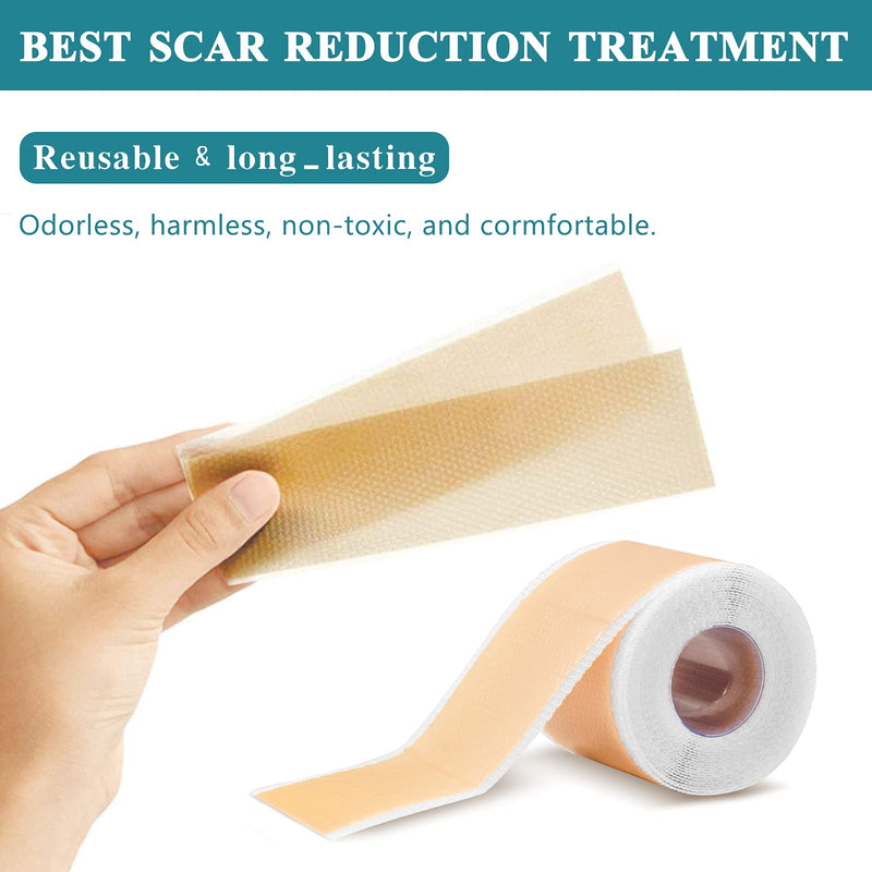 Professional Silicone Scar Sheets, Reusable Scar Sheets,Softens And Repairs Scars,Used For Scars Caused By Injuries, Burns, Acne, Stretch Marks, Washable(1.6” x 60”) - NewNest Australia