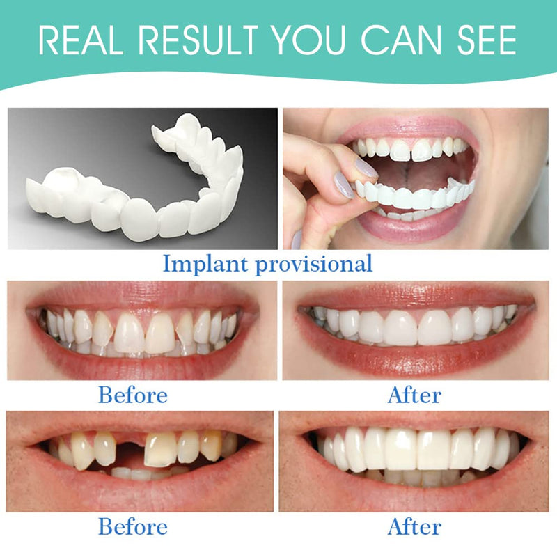 Temporary False Teeth Filling Repair, Dental Kit for Fillings Chipped Tooth, Cosmetic Dentures Temporary False Teeth Top and Bottom Tooth Cover Alternative Dentures for Men and Women - NewNest Australia