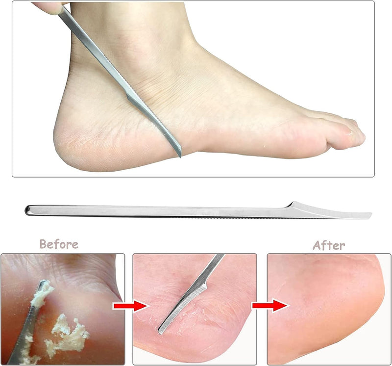 Pedicure Callus Razor Set, Callus Slicer, Foot File, Callus Remover, Feet, Stainless Steel Foot Rasp, Hard Skin Heel, Callus Removal For Hand Feet Foot Care With 10 Replacement Blades - NewNest Australia