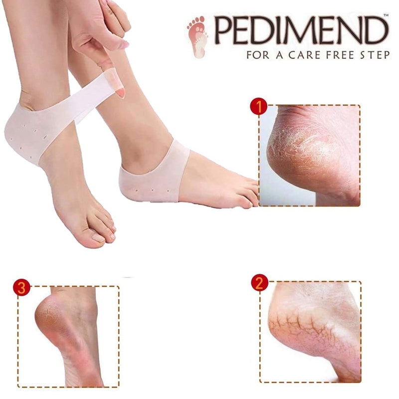 Pedimend Silicone Gel Moisturizing Heel Socks with Hole (3PAIR) - Ankle Moisturizing Pain Relief Cushion/Heel Protector for Cracked Foot/Treat Plantar Fasciitis, Heel Spurs, Heel Pain - Foot Care - NewNest Australia