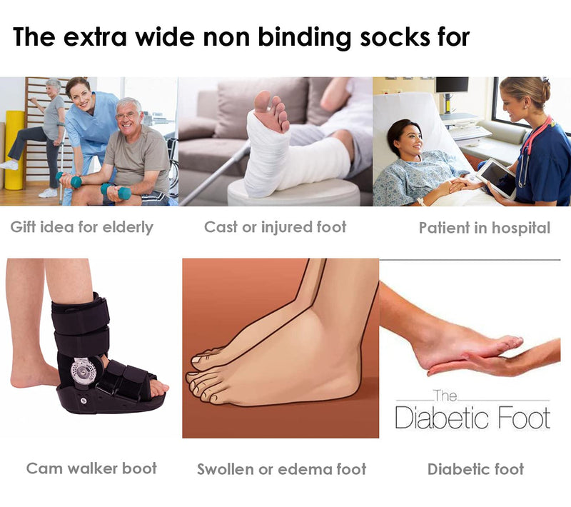 Extra Wide Socks for Lymphedema Swollen Feet Leg, Bariatric Socks, Neuropathy Medical Cast Sock, Diabetic Non Binding Socks 2 Pairs(white) - NewNest Australia