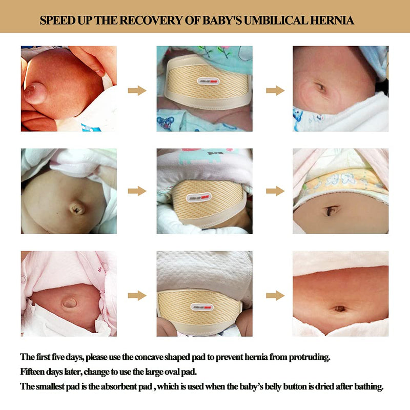 Umbilical Hernia Belt Baby Belly Button Band Infant Belly Wrap Truss Abdominal Binder for Children Kids Support Adjustable Navel Belly Band Newborn Umbilical Cord 15-20 inch - NewNest Australia