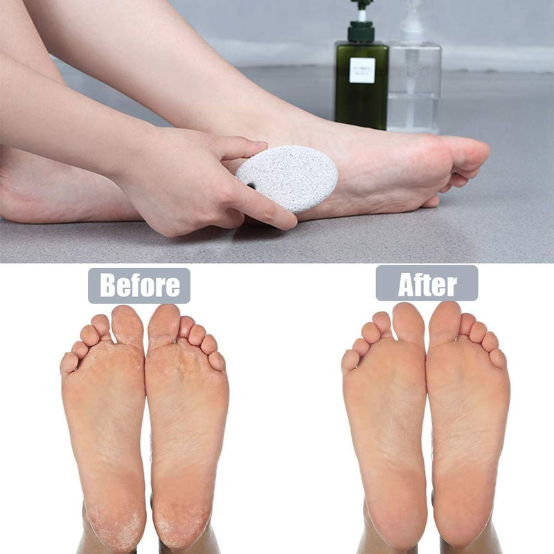 Pumice Stone 2Pcs, Natural Lava Pumice Stone for Feet/Hands/Body, White Calluse Remover/Foot Scrubber Stone for Dead/Hard Skin, Foot File for Men/Women by MAYKI Grey - NewNest Australia