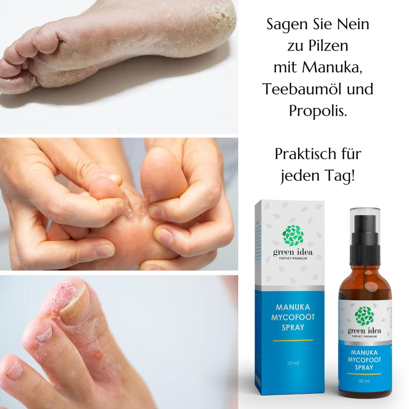 Green Idea - Foot Spray With Manuka | Mycofoot Spray | Strong Combination Manuka + Tea Tree + Propolis | Athlete Foot Spray, Athlete Foot Spray, Athlete Foot Spray, Athlete Foot Spray, Foot Sweat And - NewNest Australia