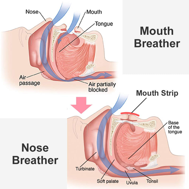 WoodyKnows Mouth Tape, Anti Snoring Mouth Strips for deep Sleep, Develop The Habit of Nasal Breathing, Maintain Natural Face Shape (Extra Strength, Newly Launched, 24 Pieces) Extra Strength (Newly Launched) 24 Pieces - NewNest Australia