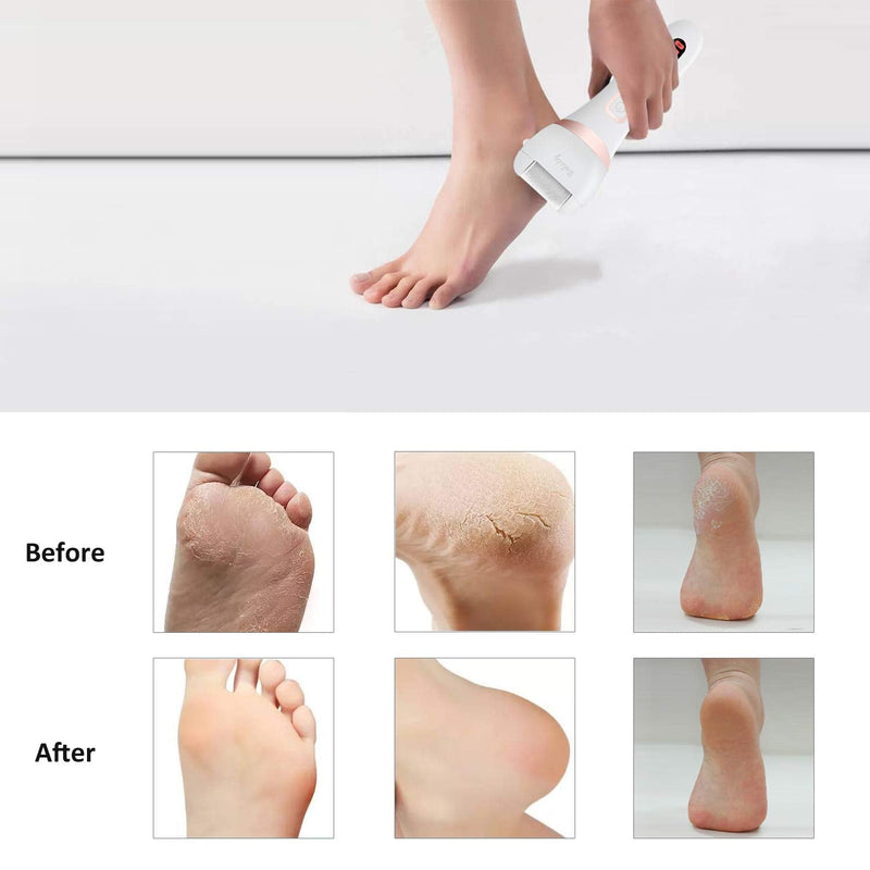 Wolady Electric Foot File, Hard Skin Remover Rechargeable Feet Scrubber Shaver Waterproof Callus Remover for Dry Dead Cracked Feet with 3 Roller Heads, White - NewNest Australia