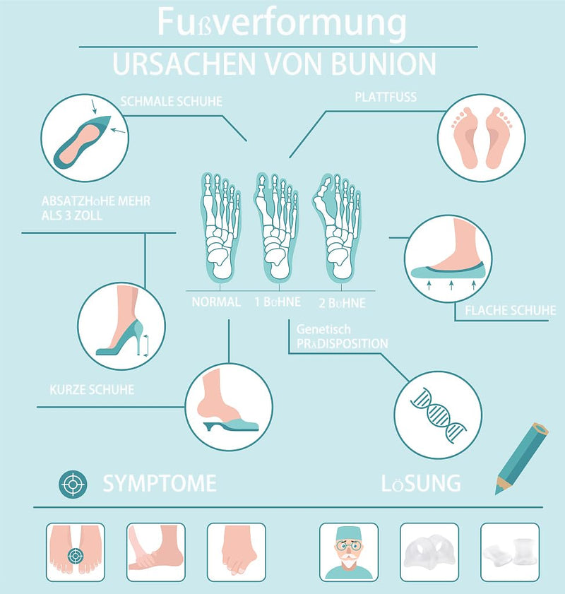 Toe spreader to correct your toes 6 pieces for 5 toe separation and relaxation, toe separator for overlapping hallux valgus toe bunions hammer toes, toe spacer bunion corrector - NewNest Australia