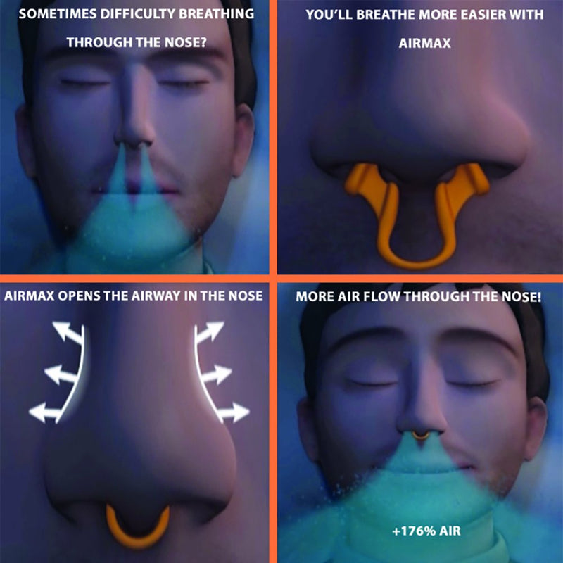 Airmax nasal dilator | Breathe better with Airmax | Against nasal congestion - Sport version - 2x small size, 6-month relief | Airmax is used by athletes to improve performance! - NewNest Australia