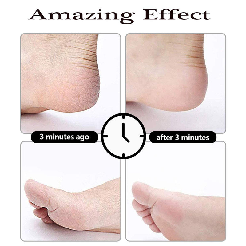 Foot File Set 20 In 1, Pedicure Set, Stainless Steel Callus Remover Callus Removal Foot Care Set, Professional Callus Removal Set, Foot Care Set For Women, Men, Salon Or Home - NewNest Australia