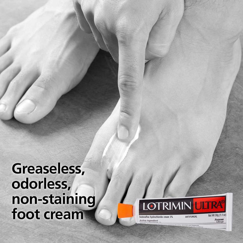 Lotrimin Ultra 1 Week Athlete's Foot Treatment, Prescription Strength Butenafine Hydrochloride 1%, Cures Most Athlete’s Foot Between Toes, Cream, 1.1 Ounce (30 Grams) 1.1 Ounce (Pack of 1) - NewNest Australia