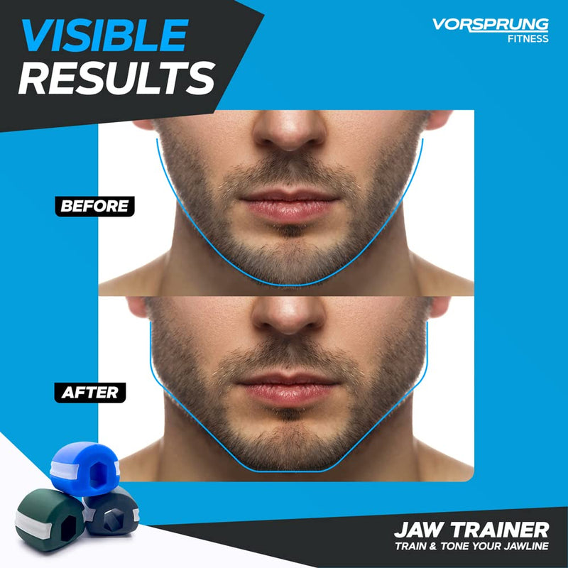 VORSPRUNG® Jaw Exerciser, Trainer for Face Mouth, Jawline Chisel & Enhance - 3 Pack, 3 Levels - Neck Exerciser - Jawline Exerciser Jawzr - Trainer men, Free 6 Biting Strips & 3 Necklaces –(UK) - NewNest Australia