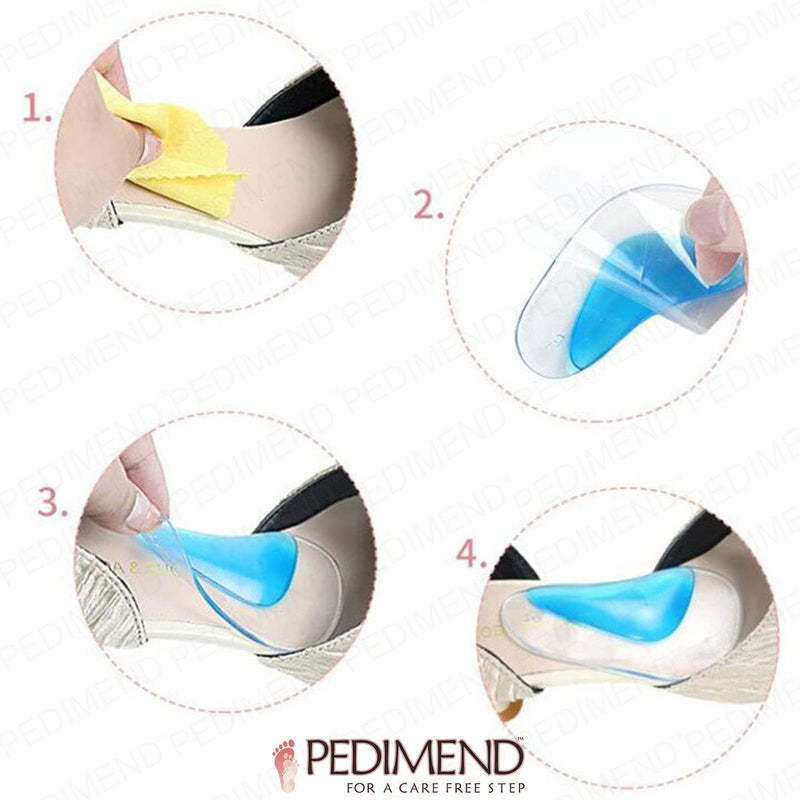 Orthotic Arch Pads, Gel Flat Foot Wedge Shoe Insert, Orthotic Shoe Transparent Adhesive Arch Pad - Arch Support Insoles Fits for Flat Feet Plantar Fasciitis by Pedimend 1 Pair - NewNest Australia