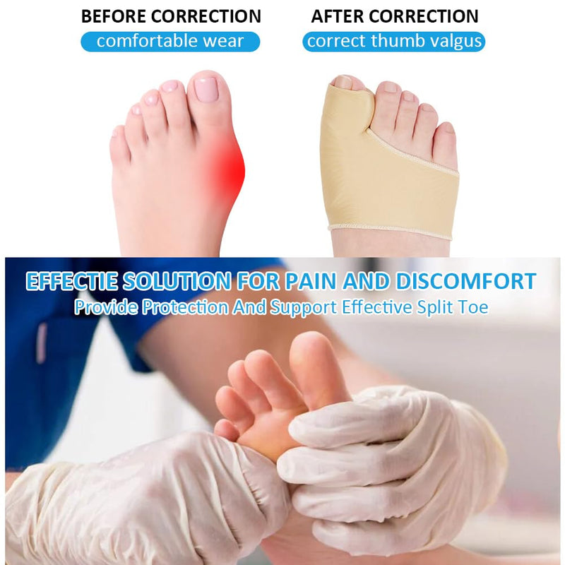 ACWOO Hallux Valgus Socks, 2 Pairs of Big Toe & Toe Relief Forefoot Pad - Hammer Toe Correction and Protection, Splint Toe Corrector for Women Men (A) A - NewNest Australia