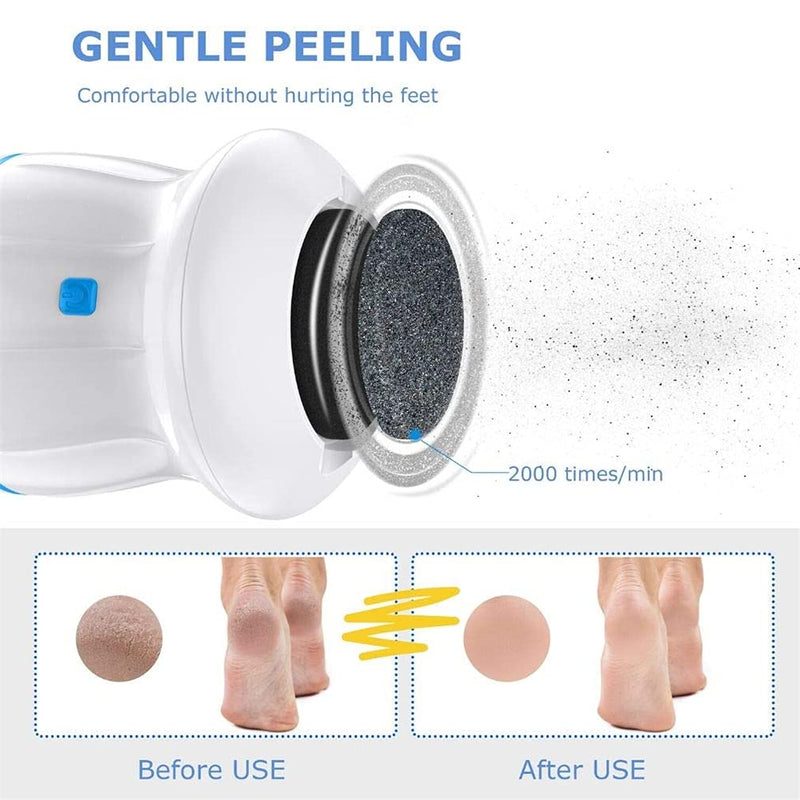 Portable Electric Foot Grinder, Electric Foot Callus Remover Electric Vacuum Adsorption Foot Grinder, Foot Heel Repair Electric Foot File Pedicure Foot Care Tool for Dead, Hard Cracked Dry Skin (Blue) Blue - NewNest Australia