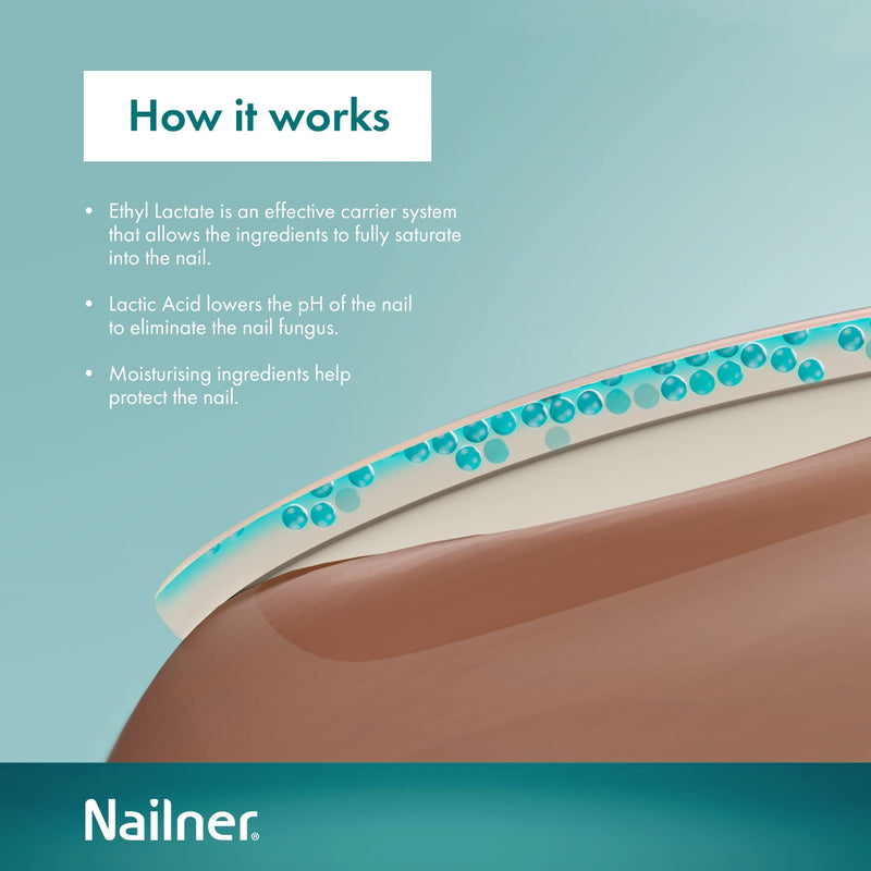 Nailner Fungal Nail Treatment Brush 5 ml - Treat & Prevent Fungal Nail Infection - Anti Fungal Nail Treatment for Toenails - Nail Fungus Treatment - Clinically Proven - 300 Applications - Clear - NewNest Australia