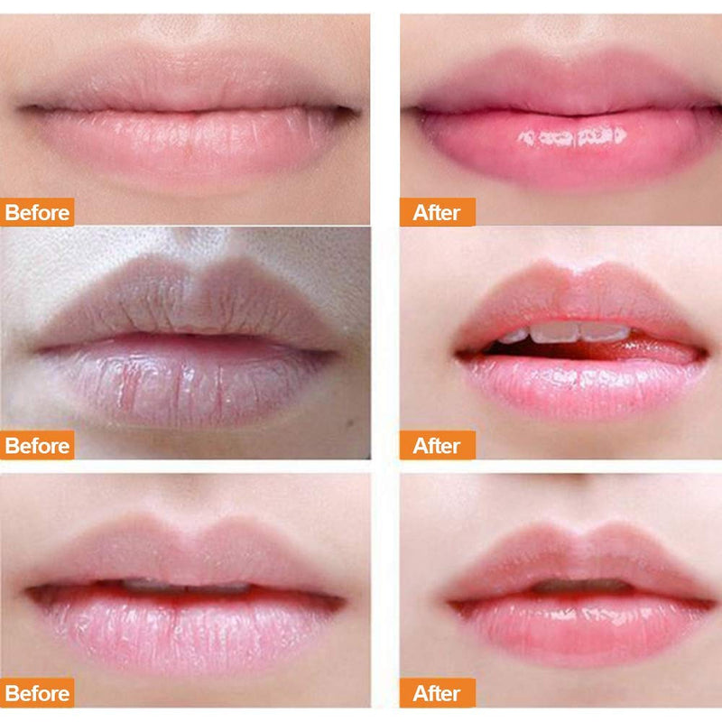 Lip Sleep Mask with two kinds of effective collagen peptide, lip scrub to remove dead skin and intensive lip repair treatment,a Lip mask for dry peeling lips, a lip balm for lip care (Strawberry) - NewNest Australia