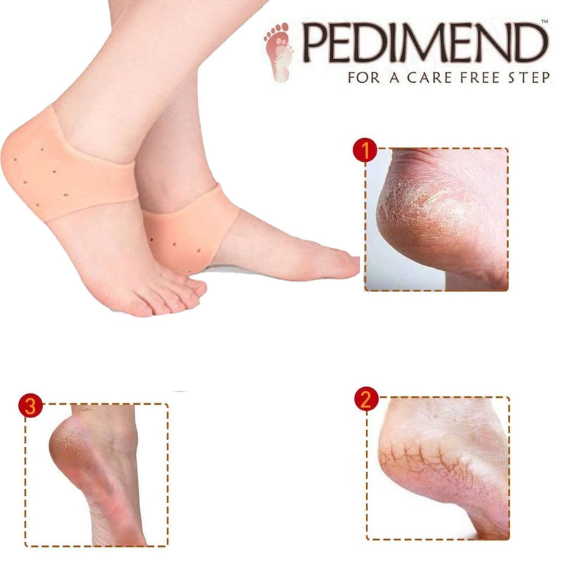 PEDIMEND Silicone Gel Heel Socks with Hole (1PAIR) - Cracked Heel Protectors - Relieve Heel Pain, Heel Pressure with Extra Cushioning – Ideal for Rough Heels - Extra Strong & Thick - Foot Care - NewNest Australia