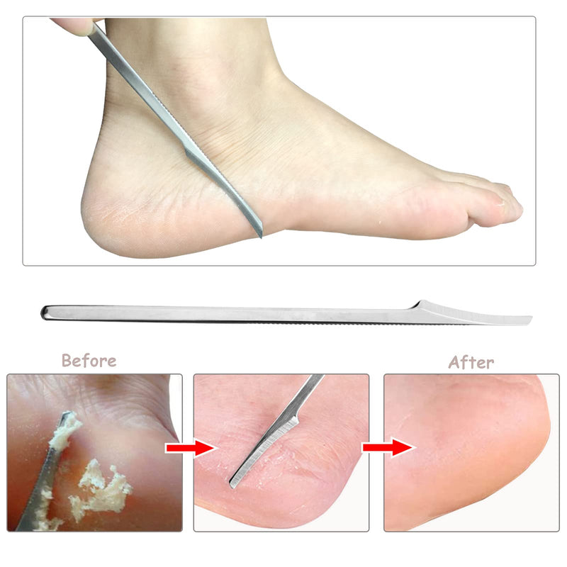 Callus Remover Foot Scraper - Stainless Steel Callus Planer Foot File Callus Rasp Hard Skin Callus Remover Foot Rasp Pedicure Foot Care Tool with 10 Replacement Blades for Wet & Dry Feet Silver - NewNest Australia