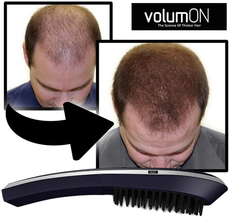 Hair Growth Brush VOLUMON® Hair Growth Treatment Laser Device to Help Prevent Further Hair Loss and Promote Hair Regrowth - Infrared Vibrating Massager with LCD Display for Men & Women - NewNest Australia