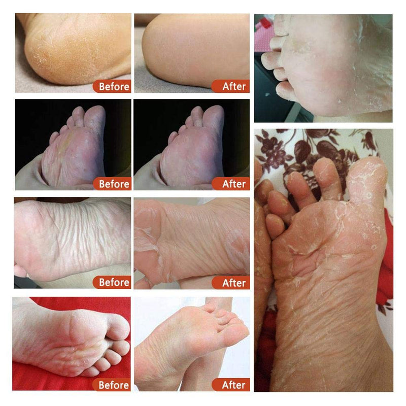 Aliver Coconut Exfoliating Peeling Renewable Foot Mask Socks Removes Dead Skin - NewNest Australia