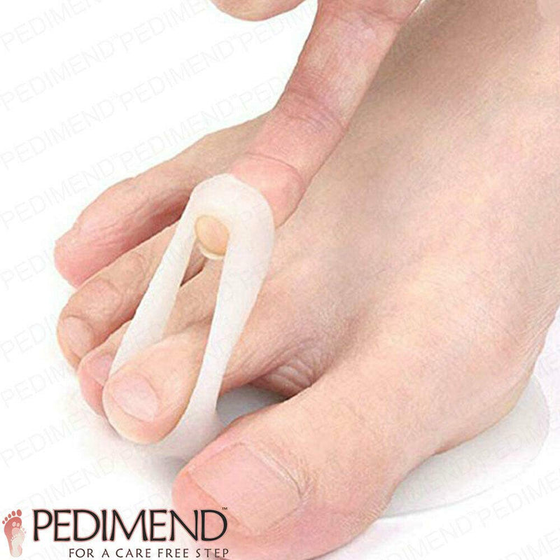 Pedimend Mortons Neuroma Running Support - 4 Pieces | Pressure Relieving Pads | Metatarsalgia Insoles | Rapid Pain Relief Sore Feet | Ball of Foot Soft Cushion | Shoe Padding Metatarsal Half Inserts - NewNest Australia