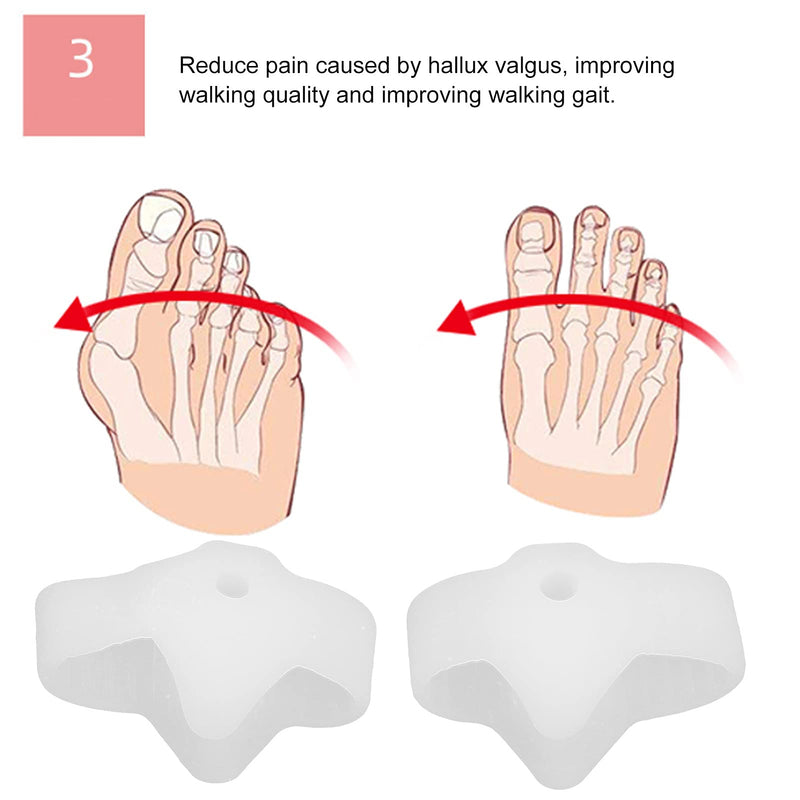 Silicone Toe Separator Made Of Soft Gel For Hallux Valgus Therapy, Prevention Of Pain And Relaxation Of The Feet, Two Toes, Bunion Correction For Bunion And Overlap Toe (White) - NewNest Australia