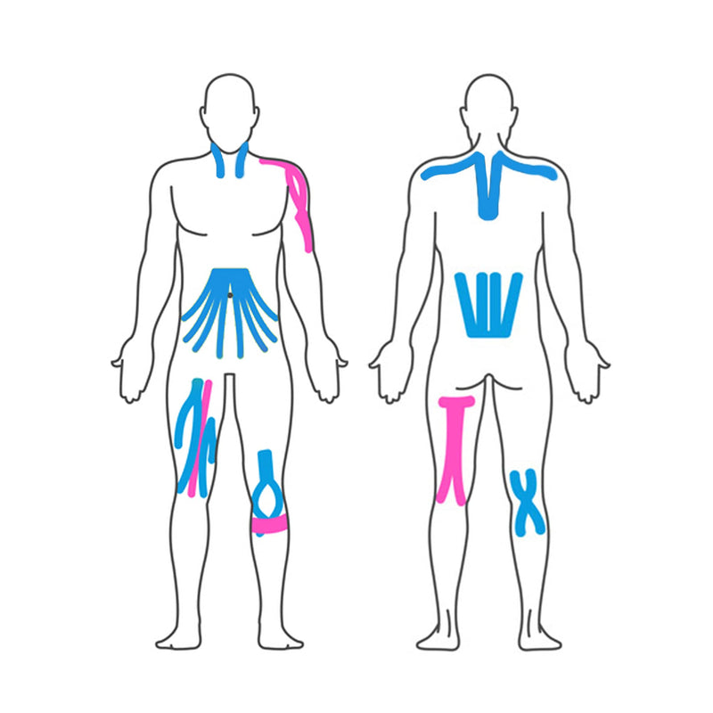 Effekt Pre Cut Kinesiology Tapes Waterproof (25 cm x 5 cm), 50 Strips - Elastic Physio Tape for Muscle Support and Injury Recovery, Medical Tape (Blue + Pink) 25x Light Blue + 25x Pink - NewNest Australia