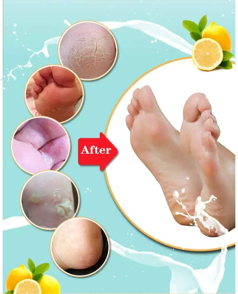 Intense exfoliant Foot Peel Peeling mask Remove Callus and Dead Skin Repair Rough Heel Eliminate Odour Foot soak Socks spa (1 Pair) - NewNest Australia