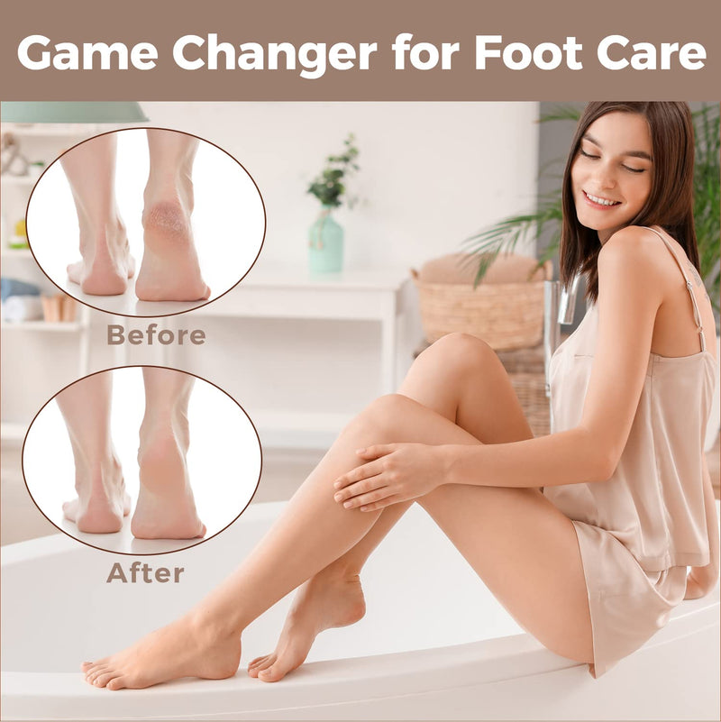 Easkep Callus Remover, Callus Rasp, Foot - Callus File, Callus Removal, Stainless Steel Callus File For Callus Remover, Strong Callus Dead Skin, Foot Scraper (Silver) - NewNest Australia