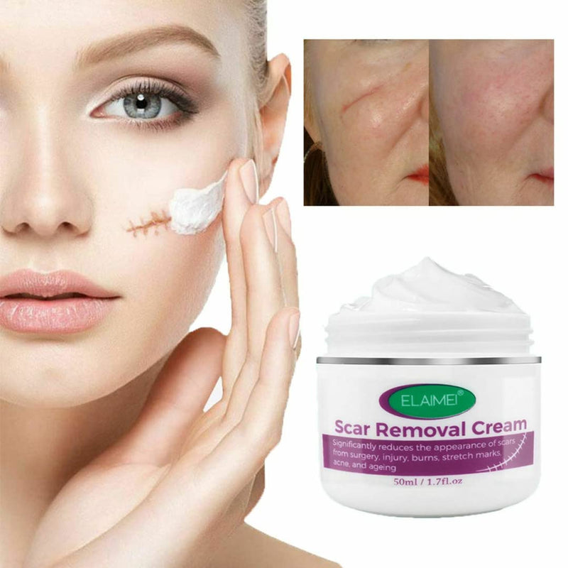Scar Removal Cream New & Appearance of Old Scars Surgery, Stretch Marks, Acne, Burns & Injuries Face or Body, Working for Removing Scars and Strech Mark for Pregnancy - NewNest Australia