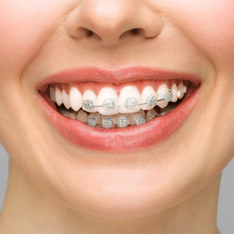 10 Boxes Dental Wax, BVN Orthodontic Wax, Dental Wax for Braces, Braces Wax, Wax for Braces, Teeth Wax, Orthodontic Wax for Braces, Relief Wax for Dental Brace Wearer and Patients for Oral Care 10 Boxes Dental Wax - NewNest Australia