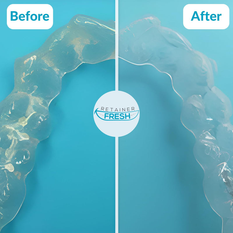 Retainer Cleaning Tablets - 120 Tablets Retainer Fresh, Keep Your Retainers and Stain Free - Retainer Cleaner Tablet, Mouth Guard, Dentures - NewNest Australia
