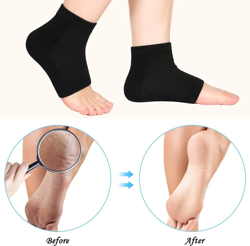Moisturizing Socks,3 Pairs, Soft Ventilate Gel Heel Socks Open Toe Socks for Dry Hard Cracked Skin Moisturizing Day Night Care Skin (Black, Regular Size) Black - NewNest Australia