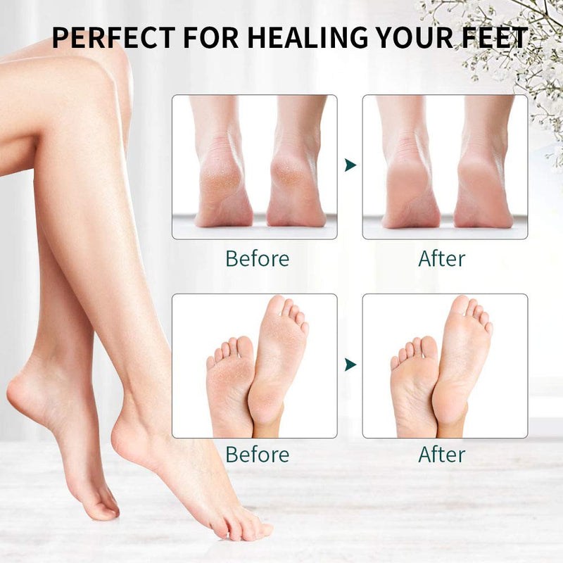 Electric Foot File, DIOZO Hard Skin Remover IPX7 Waterproof Callus Remover Pedicure Tools Machine with 3 Rollers and 2 speeds, Remove Cracked Heels and Dead Skin Off-white - NewNest Australia