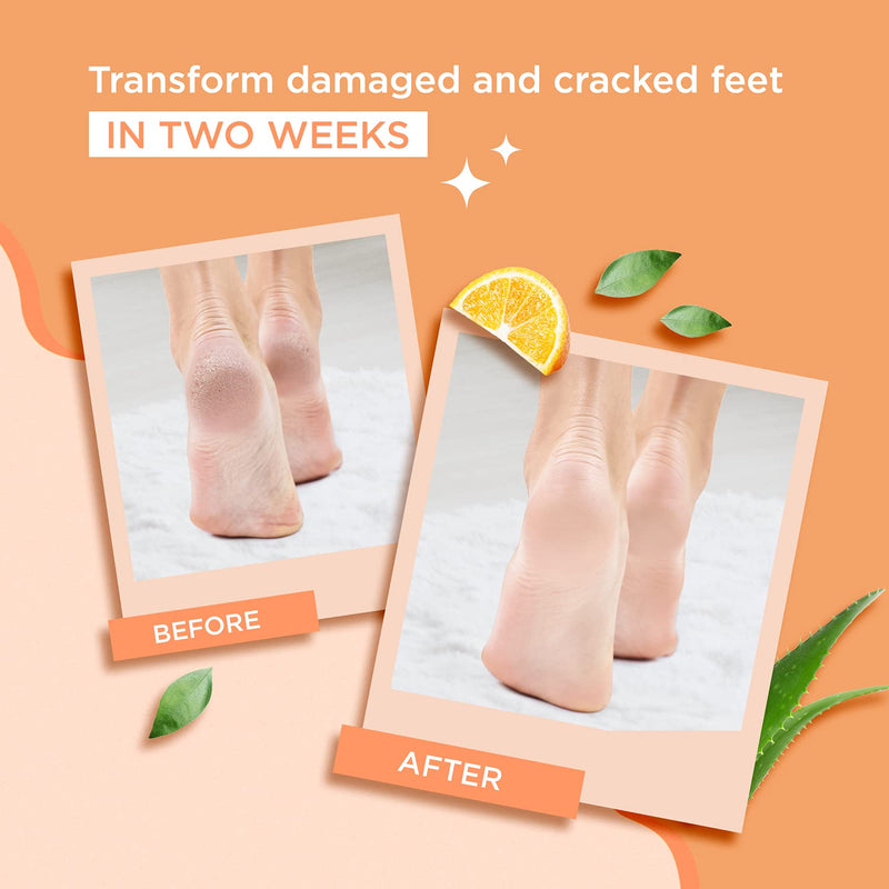 2 Pairs Exfoliating Foot Peel Mask - Repair Heels & Removes Dry Dead Skin for Soft Baby Feet - Foot Peeling Mask - Aloe Vera Gel Foot Mask, Booties Socks For Men & Women - Feet Hard Skin Remover - NewNest Australia