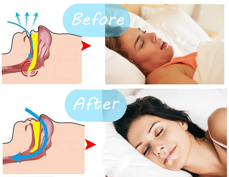 Sleep Strips Mouth Band, Adhesive Tape For Better Nose Breathing, Anti-Snoring Bands For Adults, Anti-Snoring Patch, Nose Stickers, Anti-Snoring Tapes, Less Mouth Breathing And Snoring Pack Of 120 - NewNest Australia