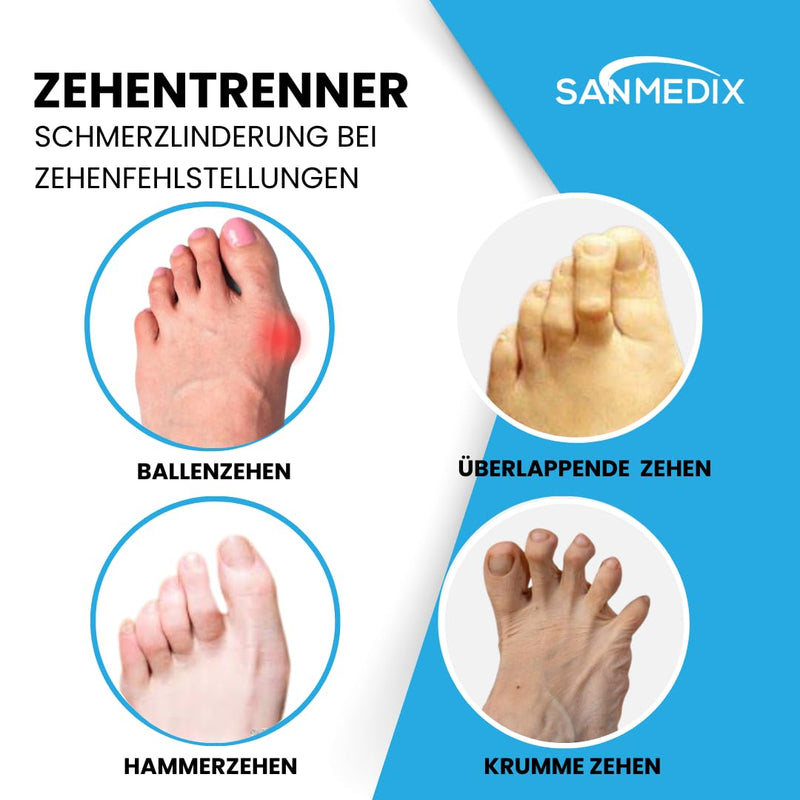 Sanmedix toe separators for all toes - 3 pairs / 6 pieces. Silicone toe separators for men and women - toe extension correction set against hallux valgus, bunions, hammer toes - NewNest Australia
