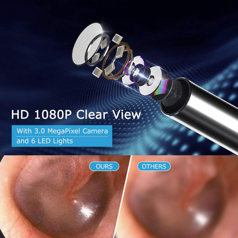 BEBIRD® R1 Ear Wax Removal Cleaner with 3.5mm Ear Camera 6 LED Lights, 1080P FHD Video Otoscope Compatible with iPhone & Android and Kids, Adults(New Spiral Structure) Black - NewNest Australia