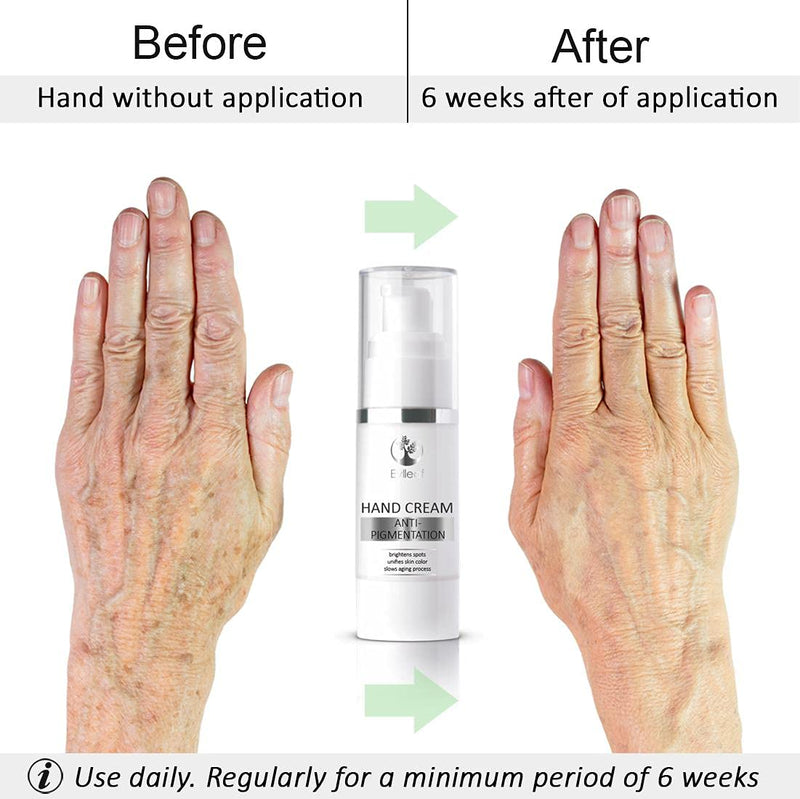 Anti-Pigmentation Hand Cream by Eylleaf Age Spot Cream Remover for Discoloration Symptoms or Mature Skin 30ml - NewNest Australia