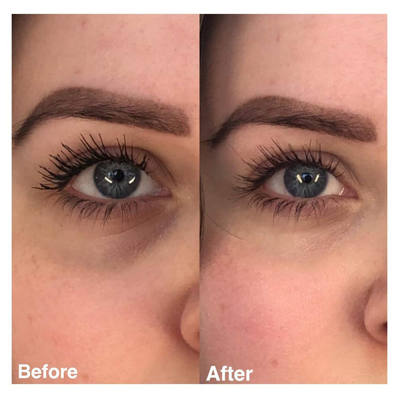 Lash Perfect iRevive Brightening Eye Serum with Hyaluronic Acid and Eyedeline Marine Extract to Reduce Dark Circles and Puffiness - NewNest Australia