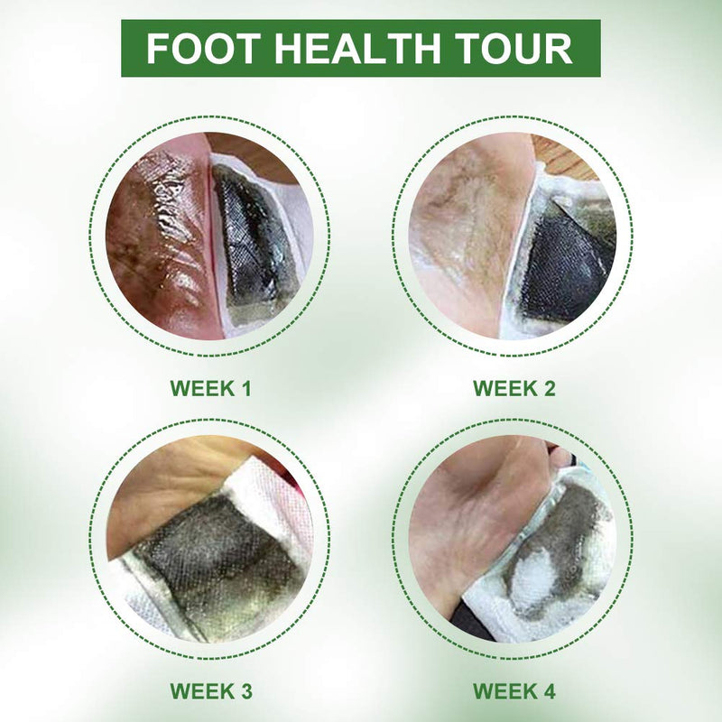 Detox Foot Plasters Vital Plasters Foot Patches Wormwood Foot Patch Promotes Blood Circulation, Relieve Pain And Improve Sleep, Free Yourself From Moisture And Cold 20 Pieces - NewNest Australia